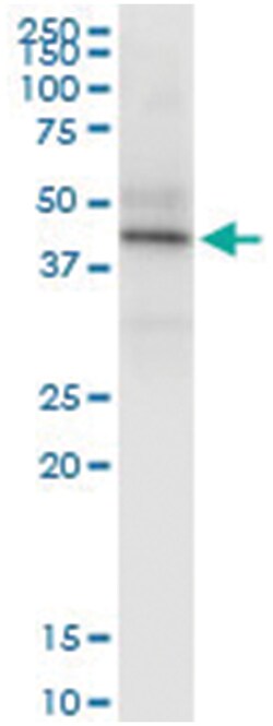 anti-HLA-C, Human, IP-WB Antibody Pair, Abnova™