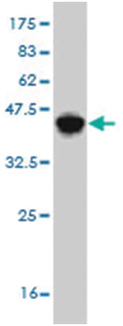 HLA-DMB, Mouse, Clone: 6B3, Abnova 100&mu;g; Unlabeled:Antibodies, Monoclonal