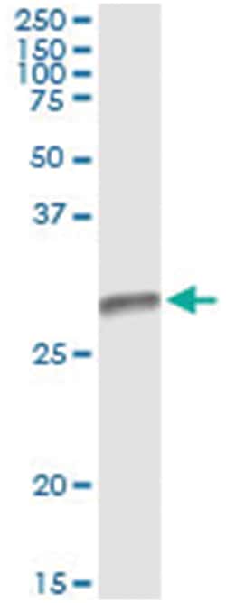 HLA-DMB, Human, IP-WB Antibody Pair (PW1), Abnova&trade;
