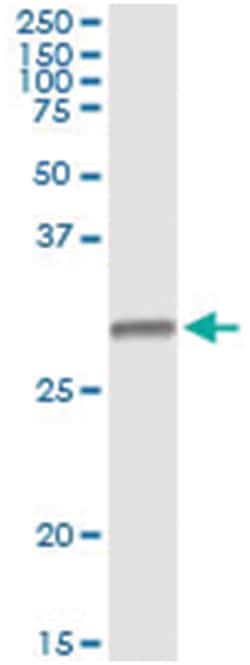 HLA-DMB, Human, IP-WB Antibody Pair (PW2), Abnova™