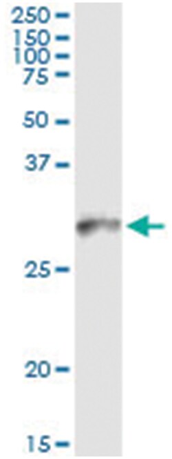 HLA-DMB, Human, IP-WB Antibody Pair (PW3), Abnova™