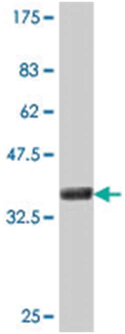 HLA-DOB, Mouse, Polyclonal Antibody, Abnova 50&mu;L; Unlabeled:Antibodies,
