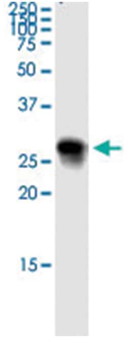 anti-HLA-DOB, Human, IP-WB Antibody Pair, Abnova&trade;