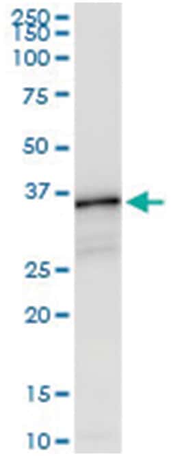 anti-HLA-DQB1, Human, IP-WB Antibody Pair, Abnova&trade;