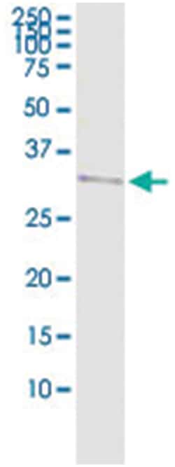 anti-HLA-DRA, Human, IP-WB Antibody Pair, Abnova 1 Set:Antibodies, Monoclonal/Polyclonal