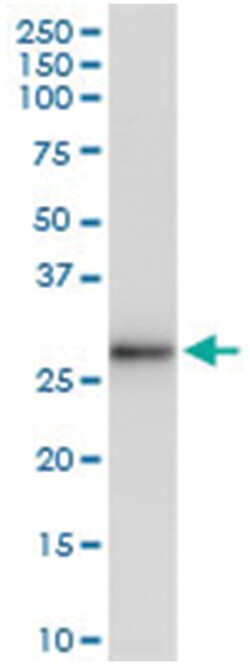 anti-HLA-DRB5, Human, IP-WB Antibody Pair, Abnova&trade;