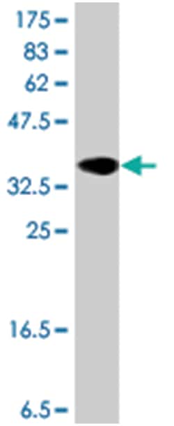 MR1, Mouse, Polyclonal Antibody, Abnova 50&mu;L; Unlabeled:Antibodies,