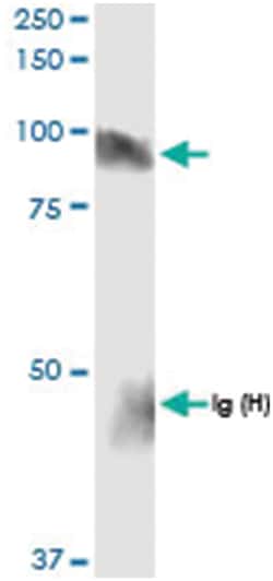 anti-HLCS, Human, IP-WB Antibody Pair, Abnova™