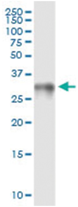 anti-HMGB1, Human, IP-WB Antibody Pair, Abnova™