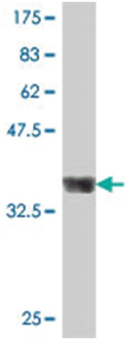 FOXA2, Mouse, Polyclonal Antibody, Abnova 50&mu;L; Unlabeled:Antibodies,