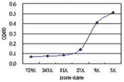 anti-HOXB1 Matched Antibody Pair, Abnova 1 Set, Unlabeled:Antibodies, Monoclonal/Polyclonal