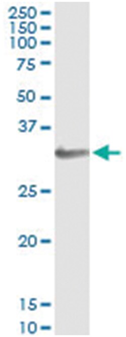 HOXB1, Human, IP-WB Antibody Pair (PW2), Abnova&trade;