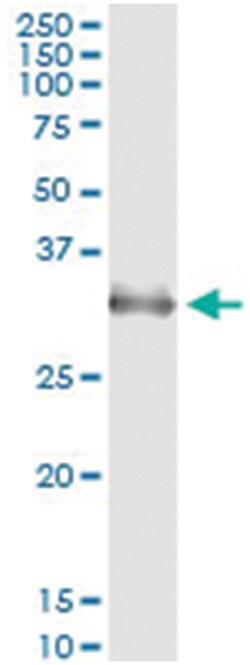 Abnova Corporation HOXB1, Human, IP-WB Antibody Pair (PW3), Abnova™