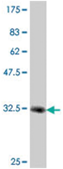 HOXB7, Mouse, Polyclonal Antibody, Abnova 50&mu;L; Unlabeled:Antibodies,