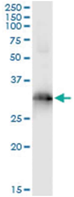 HOXB9, Human, IP-WB Antibody Pair (PW1), Abnova&trade;
