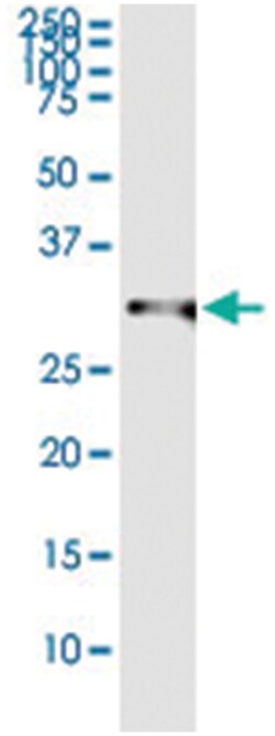 HOXB9, Human, IP-WB Antibody Pair (PW5), Abnova&trade;