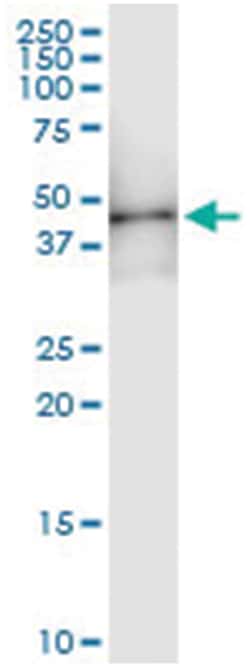 HOXD1, Human, IP-WB Antibody Pair (PW1), Abnova™