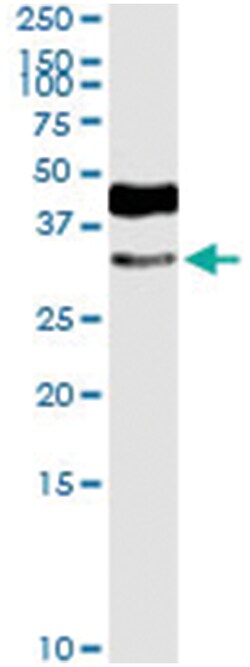 anti-HOXD8, Human, IP-WB Antibody Pair, Abnova 1 Set:Antibodies, Monoclonal/Polyclonal