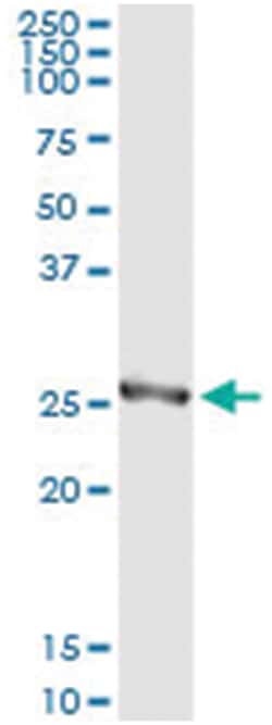 anti-HPGD, Human, IP-WB Antibody Pair, Abnova&trade;