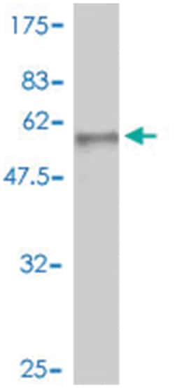 HPRT1, Mouse, Polyclonal Antibody, Abnova 50&mu;L; Unlabeled:Antibodies,