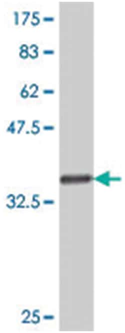 HRBL, Mouse, Polyclonal Antibody, Abnova 50&mu;L; Unlabeled:Antibodies,