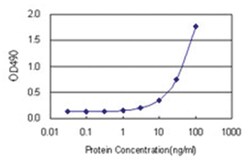 anti-HSD3B1 Matched Antibody Pair, Abnova™