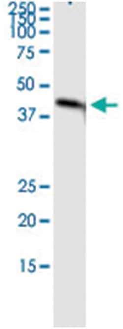 anti-HSD11B2, Human, IP-WB Antibody Pair, Abnova&trade;