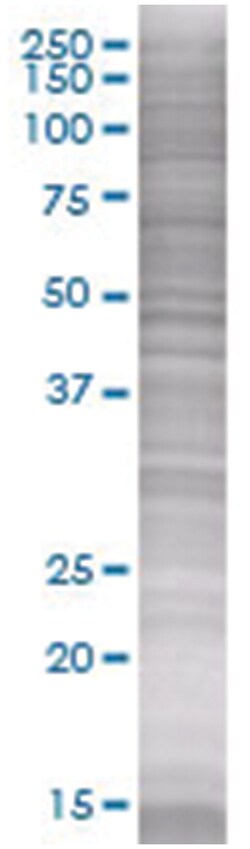 HSD17B2 293T Cell Overexpression Lysate 1 (Denatured), Abnova 100 &mu;L | Buy Online | Abnova | Fisher Scientific