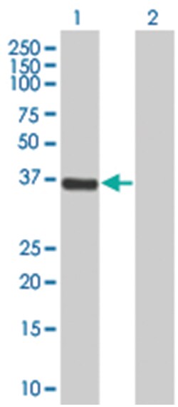 HSD17B2 293T Cell Overexpression Lysate 1 (Denatured), Abnova 100 &mu;L | Buy Online | Abnova | Fisher Scientific