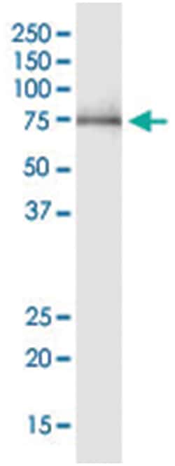 HSPA1L, Human, IP-WB Antibody Pair (PW2), Abnova&trade;