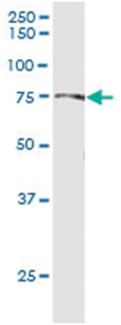 HSPA1L, Human, IP-WB Antibody Pair (PW3), Abnova 1 Set:Antibodies, Monoclonal/Polyclonal