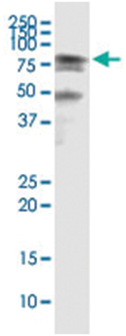 HSPA2, Human, IP-WB Antibody Pair (PW4), Abnova 1 Set | Buy Online | Abnova Corporation | Fisher Scientific