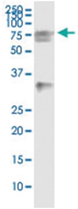 HSPA2, Human, IP-WB Antibody Pair (PW5), Abnova 1 Set:Antibodies, Monoclonal/Polyclonal