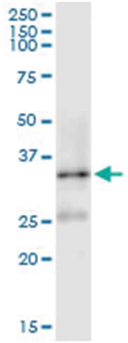 anti-DNAJB1, Human, IP-WB Antibody Pair, Abnova&trade;