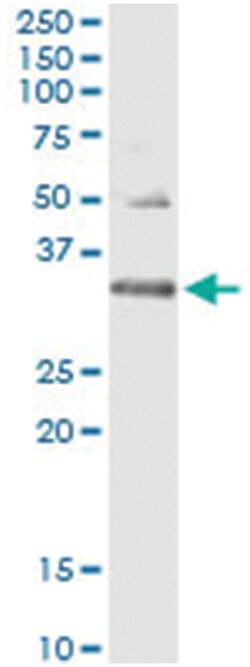 HUS1, Human, IP-WB Antibody Pair (PW2), Abnova™