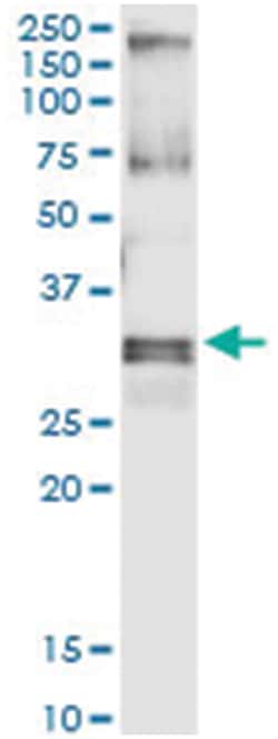 HUS1, Human, IP-WB Antibody Pair (PW3), Abnova&trade;