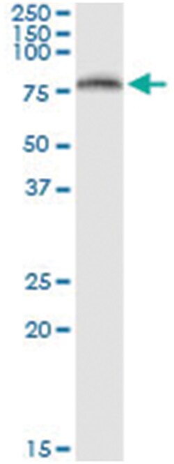 ICAM1, Human, IP-WB Antibody Pair (PW1), Abnova 1 Set:Antibodies, Monoclonal/Polyclonal