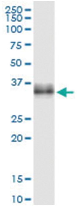 anti-ICAM4, Human, IP-WB Antibody Pair, Abnova 1 Set:Antibodies, Monoclonal/Polyclonal