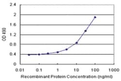 anti-ID2 Matched Antibody Pair, Abnova