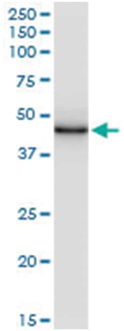anti-IDH2, Human, IP-WB Antibody Pair, Abnova&trade;