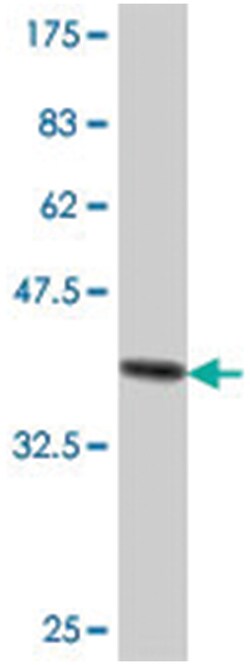IDI1 (A01), Mouse anti-Human, Polyclonal Antibody, Abnova 50&mu;L; Unlabeled:Antibodies,