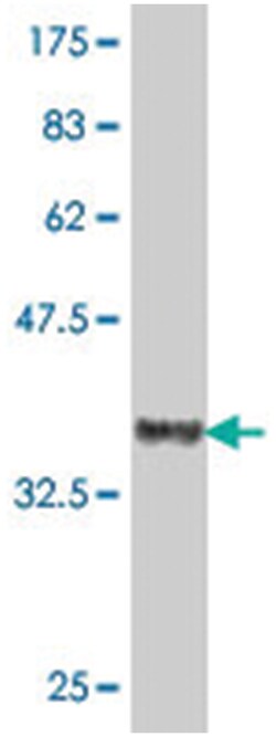 IF, Mouse, Polyclonal Antibody, Abnova 50&mu;L; Unlabeled:Antibodies, Polyclonal