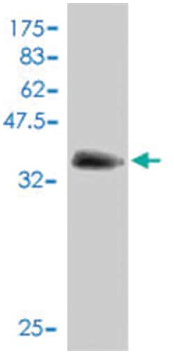 IFI16, Mouse, Polyclonal Antibody, Abnova 50&mu;L; Unlabeled:Antibodies,