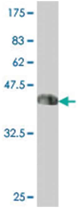 SP110, Mouse, Polyclonal Antibody, Abnova 50&mu;L; Unlabeled:Antibodies,