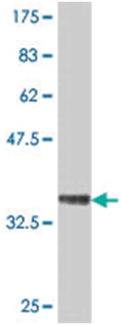 IFNA8, Mouse, Polyclonal Antibody, Abnova 50&mu;L; Unlabeled:Antibodies,