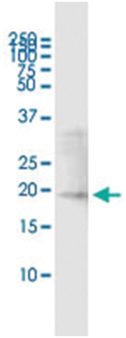 anti-IFNA17, Human, IP-WB Antibody Pair, Abnova&trade;