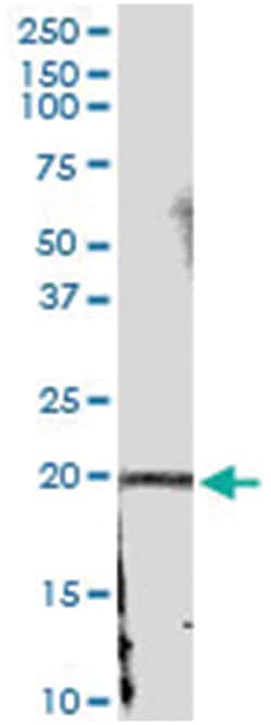 anti-IFNA21, Human, IP-WB Antibody Pair, Abnova™