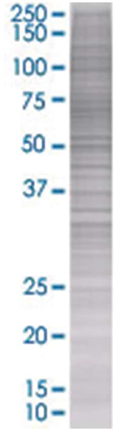 IFNAR1 293T Cell Overexpression Lysate (Denatured), Abnova 100 &mu;L | Buy Online | Abnova | Fisher Scientific