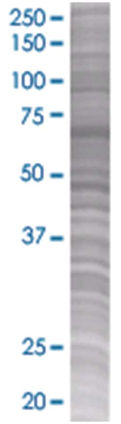 IFNB1 293T Cell Overexpression Lysate (Denatured), Abnova 100 &mu;L | Buy Online | Abnova | Fisher Scientific