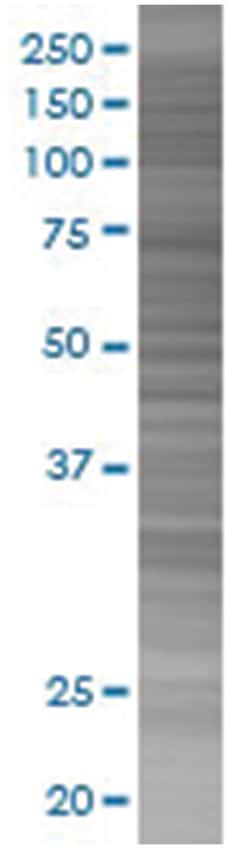 100UL IFNGR1 293T Cell Transient Overexpression Ly